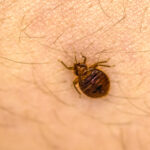 Bed Bug On Skin